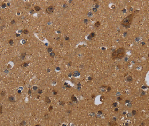 NDUFS8 Polyclonal Antibody - 3