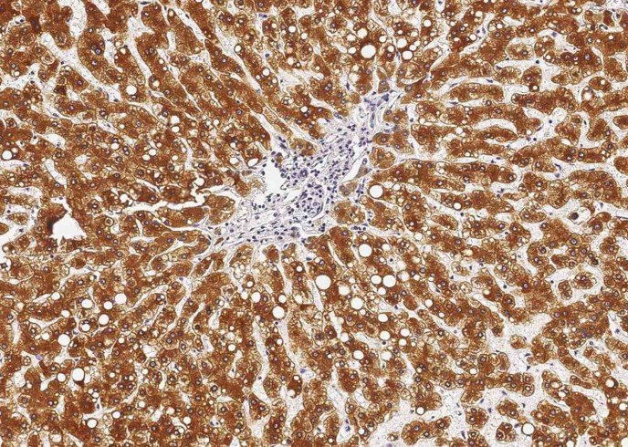 Recombinant Cathepsin D/CTSD Monoclonal Antibody - small - 2