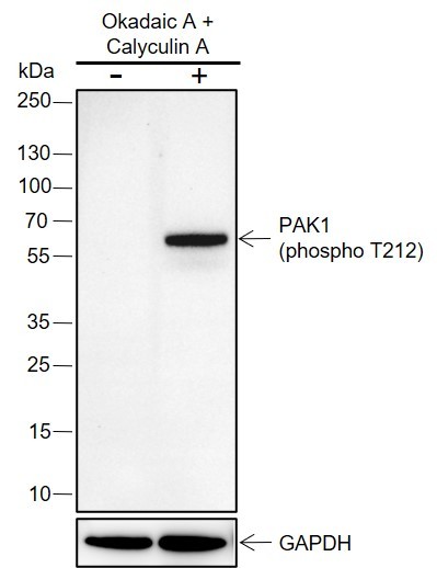 Recombinant Phospho-PAK1 (Thr212) Monoclonal Antibody - 2