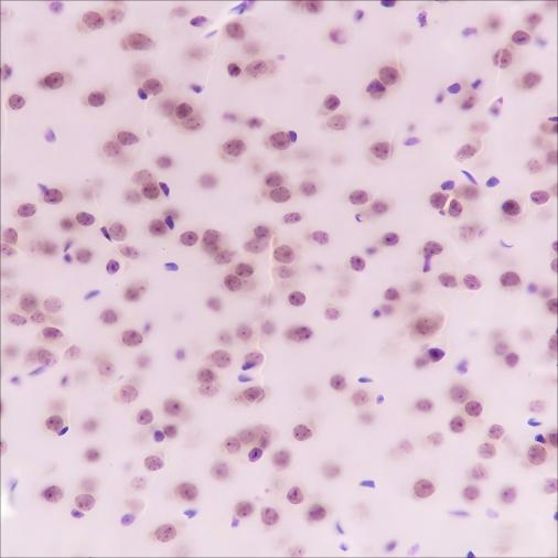 Recombinant AKT1 Monoclonal Antibody - 3