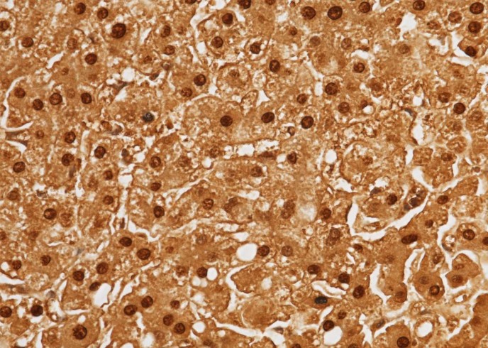 Recombinant ARG1/Arginase 1 Monoclonal Antibody-searchlist-1