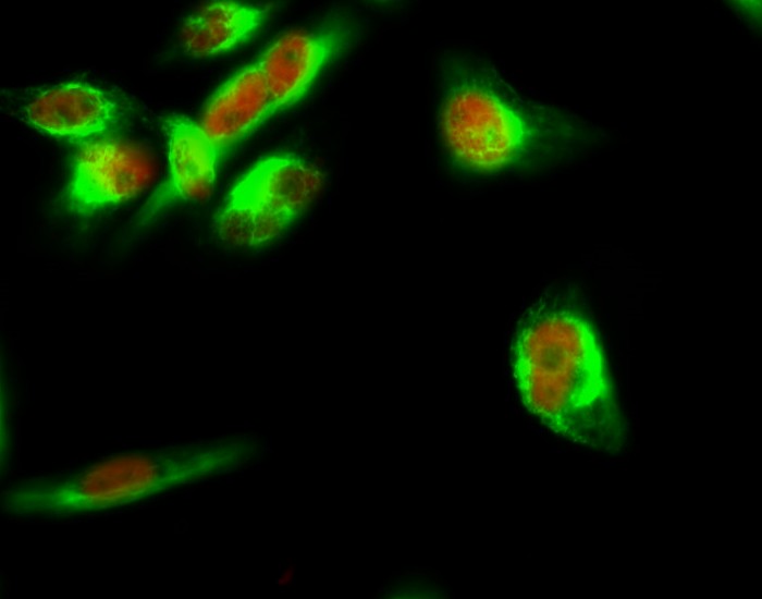 Recombinant STAT3 Monoclonal Antibody - small - 4