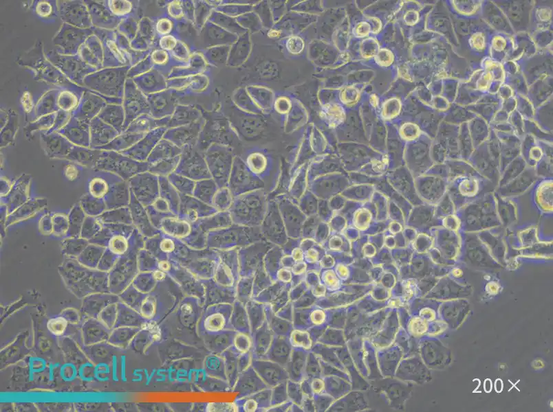 SK-BR-3 [SKBR3] Cell Complete Medium - small - 5