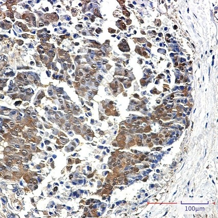 Recombinant 4E-BP1/EIF4EBP1 Monoclonal Antibody - 3