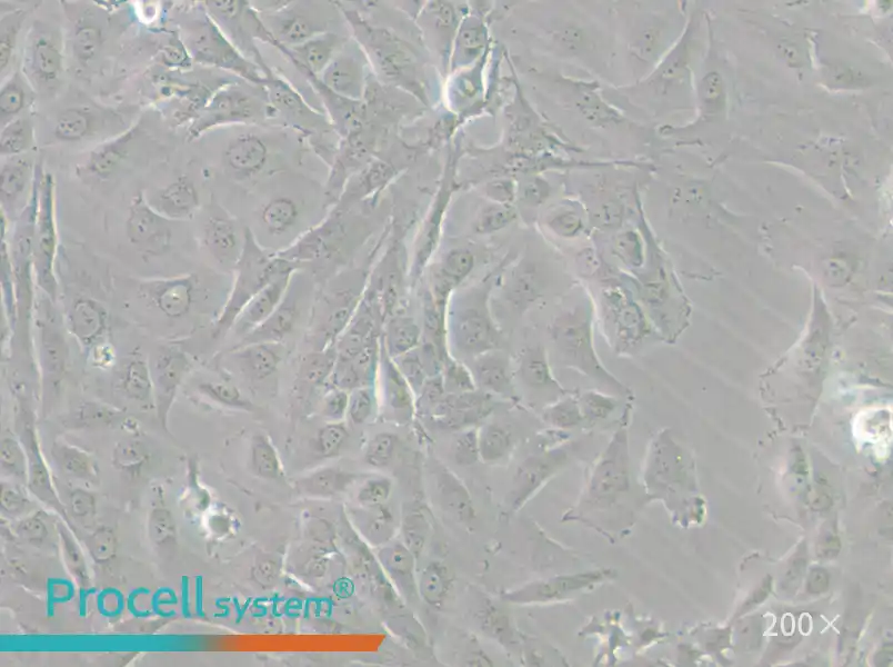 J82 Cell Complete Medium - small - 6