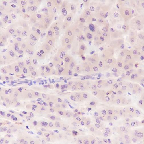 Recombinant Caspase-7 Monoclonal Antibody - small - 4