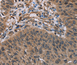 HOMER1 Polyclonal Antibody - 2