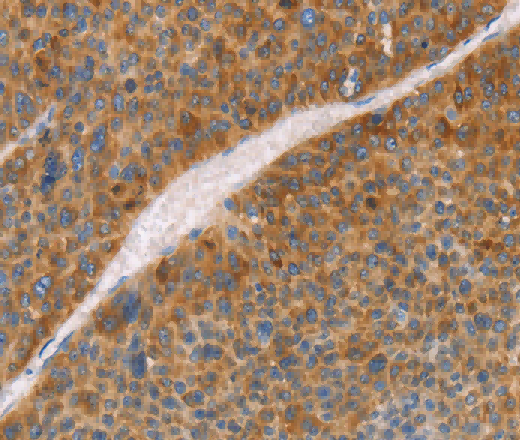 FGL1 Polyclonal Antibody - 2