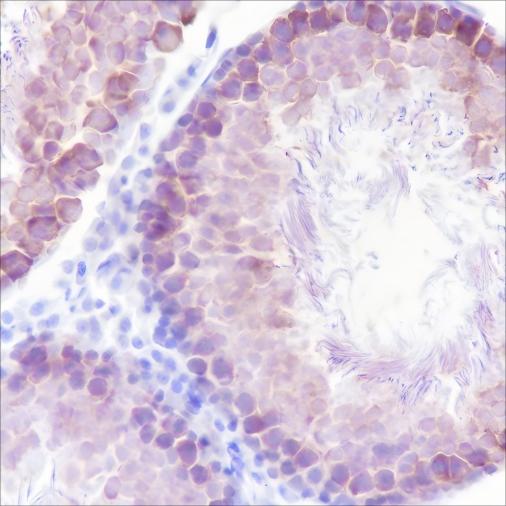 Recombinant STIP1/STI1 Monoclonal Antibody - small - 3