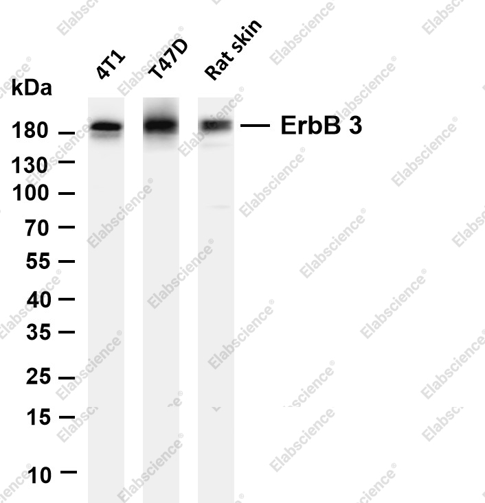 Recombinant ErbB3/HER3 Monoclonal Antibody - 1