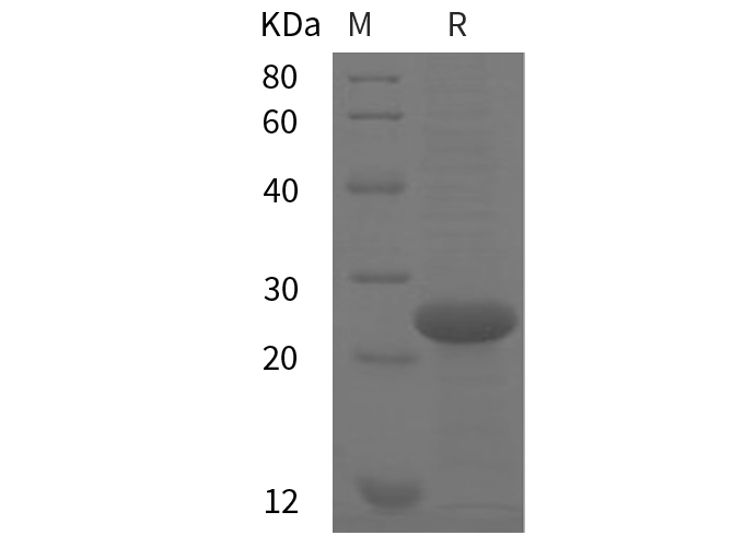 Recombinant Mouse IL-5 Protein(Fc Tag)-产品推荐-1