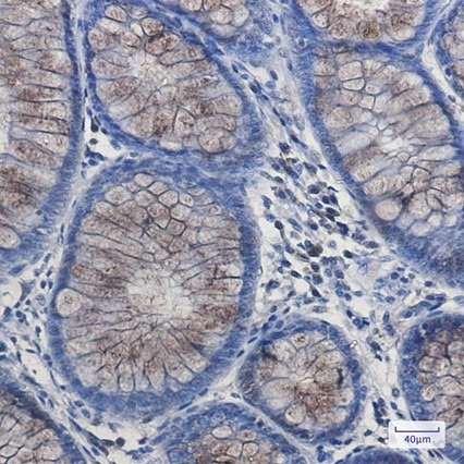 Recombinant DYNLL1 Monoclonal Antibody - 2