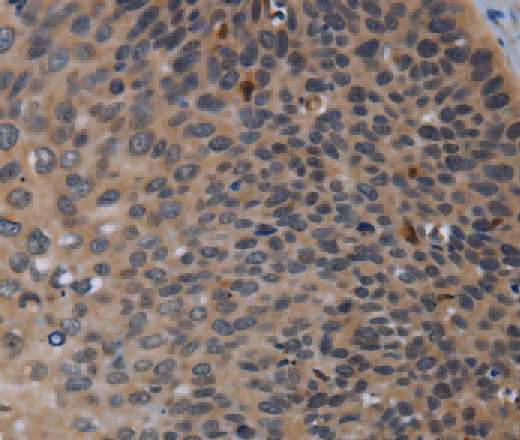 P2RX2 Polyclonal Antibody - 3
