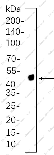Recombinant NDRG1 Monoclonal Antibody - 1