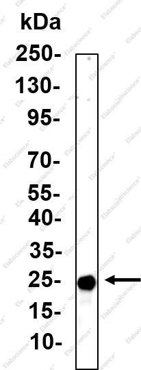 Recombinant GRB2 Monoclonal Antibody - 1