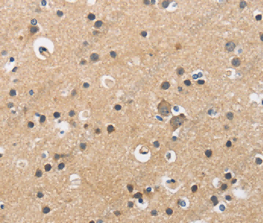 CKMT2 Polyclonal Antibody - 2