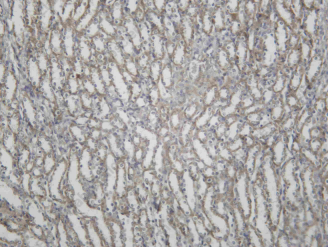 Recombinant N WASP Monoclonal Antibody - 1