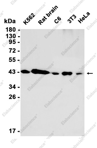 Recombinant ATP6V0D1 Monoclonal Antibody - 2