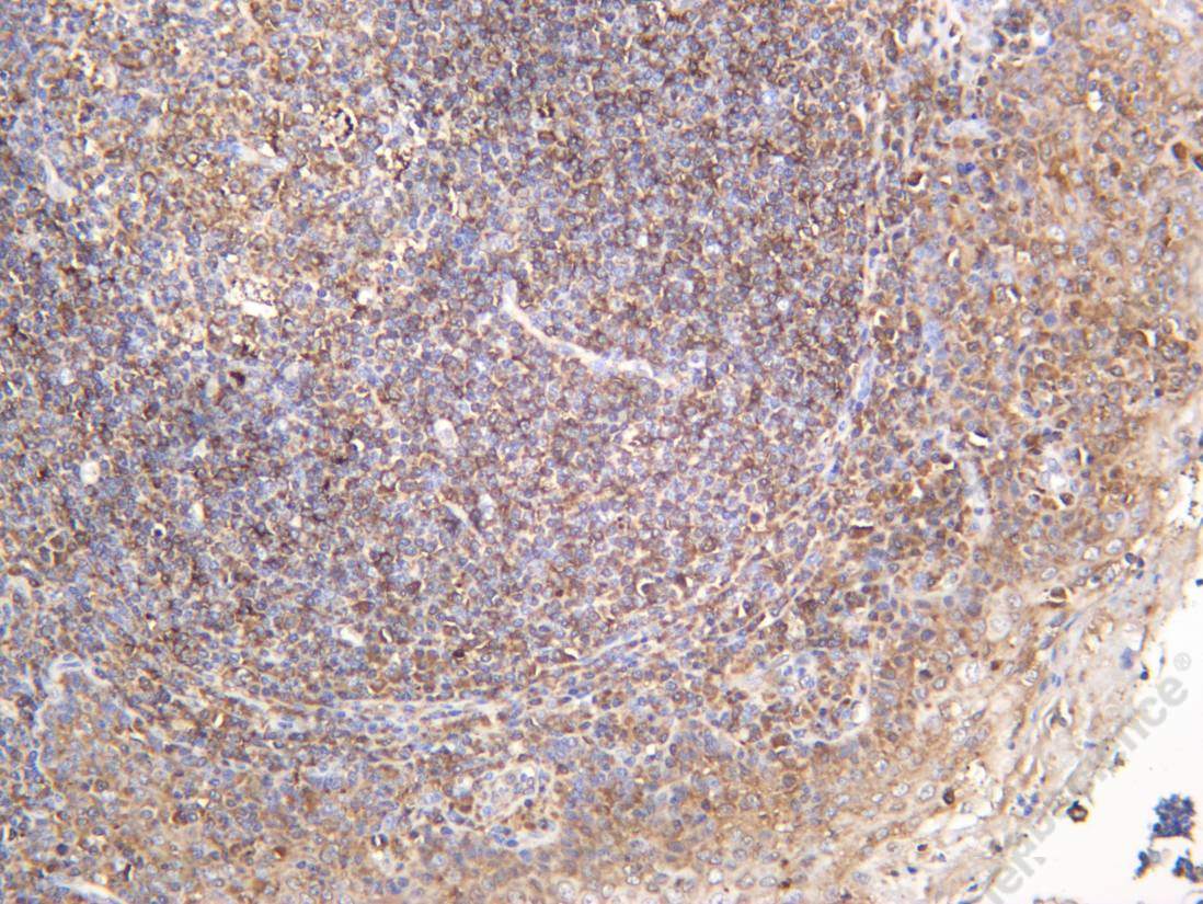 Recombinant eRF3a Monoclonal Antibody - 2