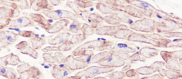 Recombinant Caveolin-3 Monoclonal Antibody-searchlist-2