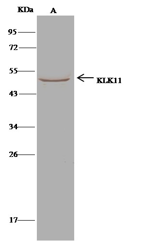 Recombinant KLK-11/Kallikrein-11 Monoclonal Antibody - small - 1