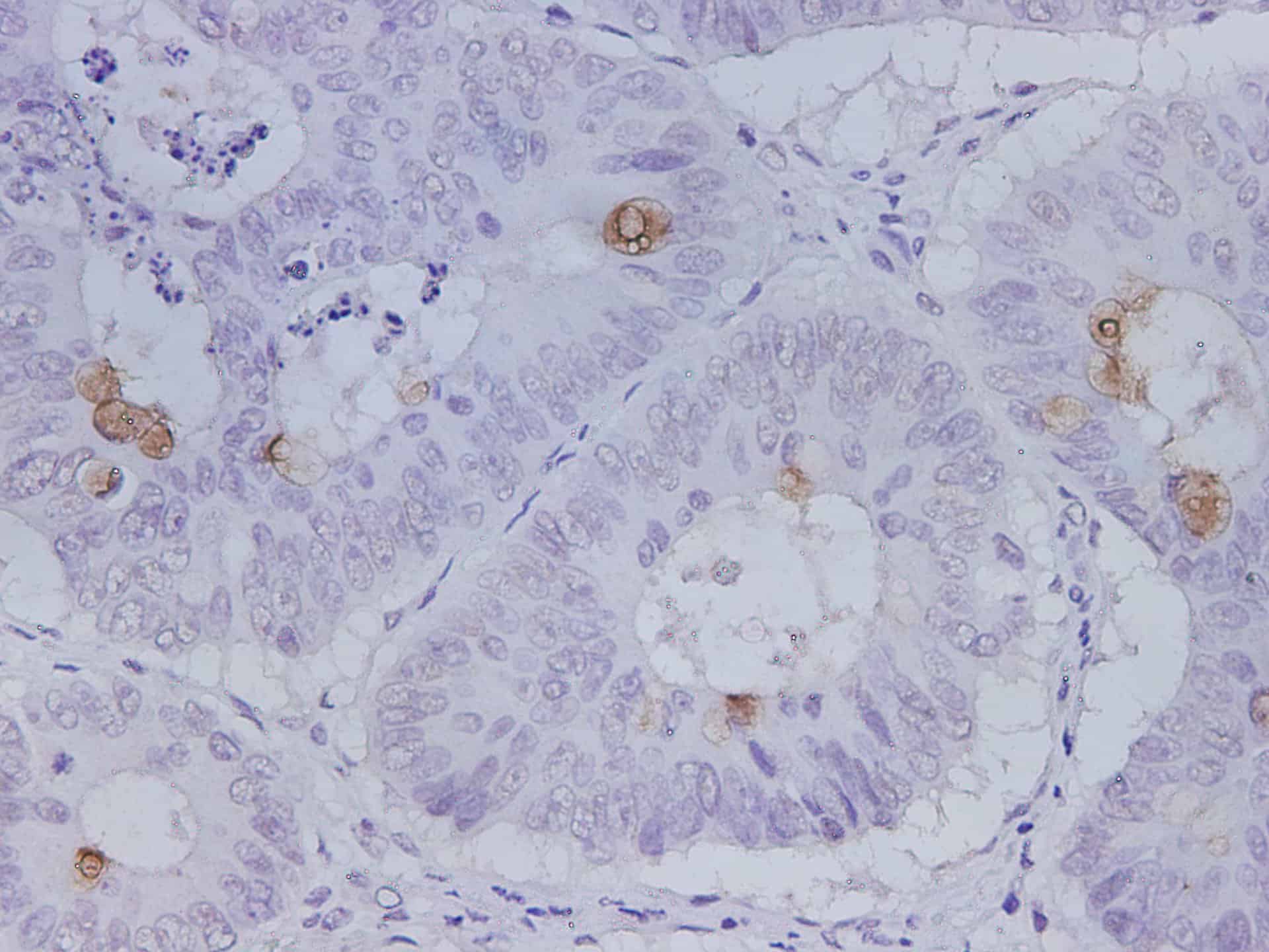 PE/Elab Fluor® 594 Mouse IgG1, κ Isotype Control[MOPC-21]-产品推荐-1