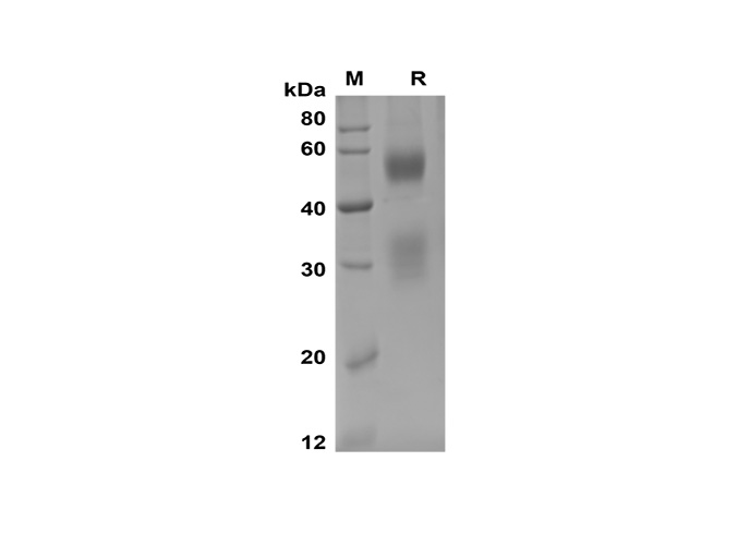 Recombinant mouse TGF-beta 2/TGFB2 Protein(His Tag)-产品推荐-1