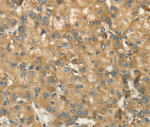 HSD17B8 Polyclonal Antibody - 2
