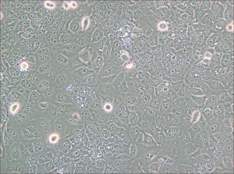 KYSE-30 Cell Complete Medium - small - 5