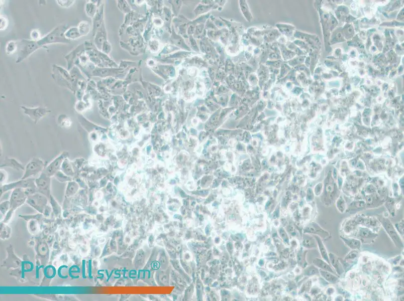 MES-SA Cell Complete Medium - 5
