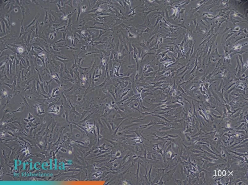 Mouse Cardiac Fibroblasts Isolation and Culture Kit - small - 2