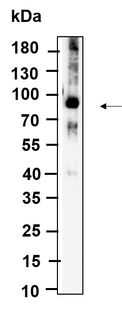 Recombinant ALDH16A1 Monoclonal Antibody-searchlist-1