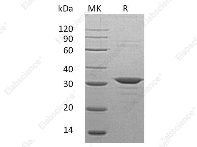 Recombinant Human CLIC4 Protein (His Tag) - 1