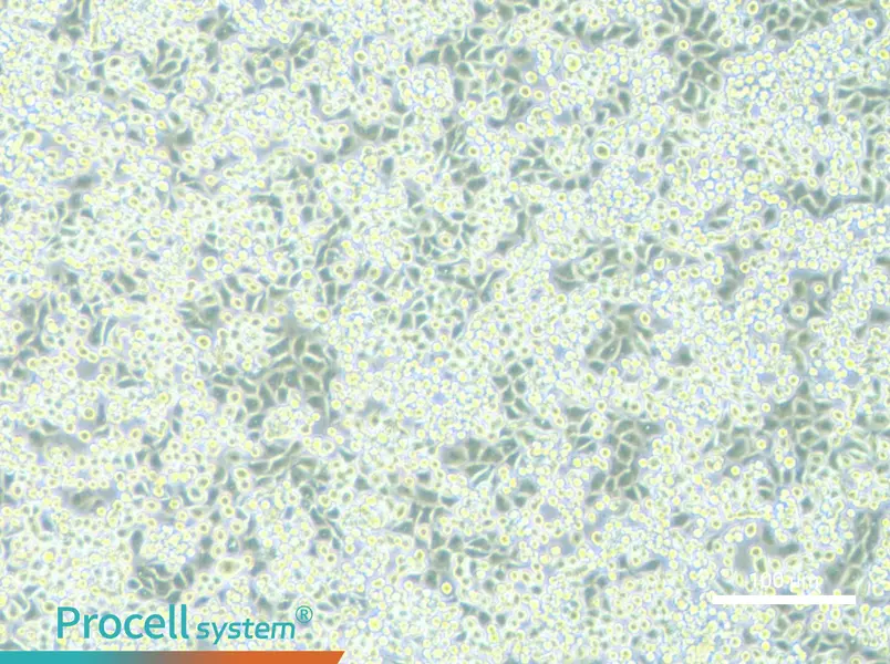 NCI-H2122 - 1