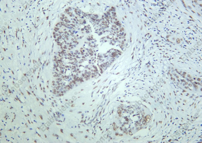 Recombinant 53BP1 Monoclonal Antibody - 2