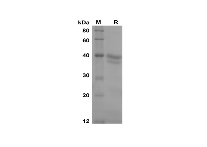 Recombinant Human FGF21 Protein (Sumo Tag)-1