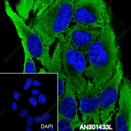 Recombinant alpha Actinin 4 Monoclonal Antibody - 3