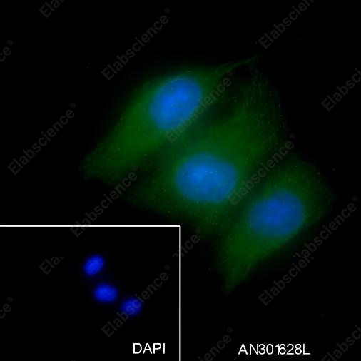 Recombinant Aurora B Monoclonal Antibody - 4