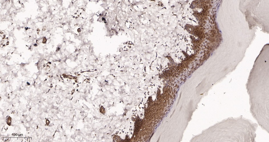 Recombinant Collagen III Monoclonal Antibody - small - 3