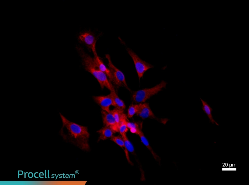 Rat Prostate Epithelial Cell Complete Medium - 2