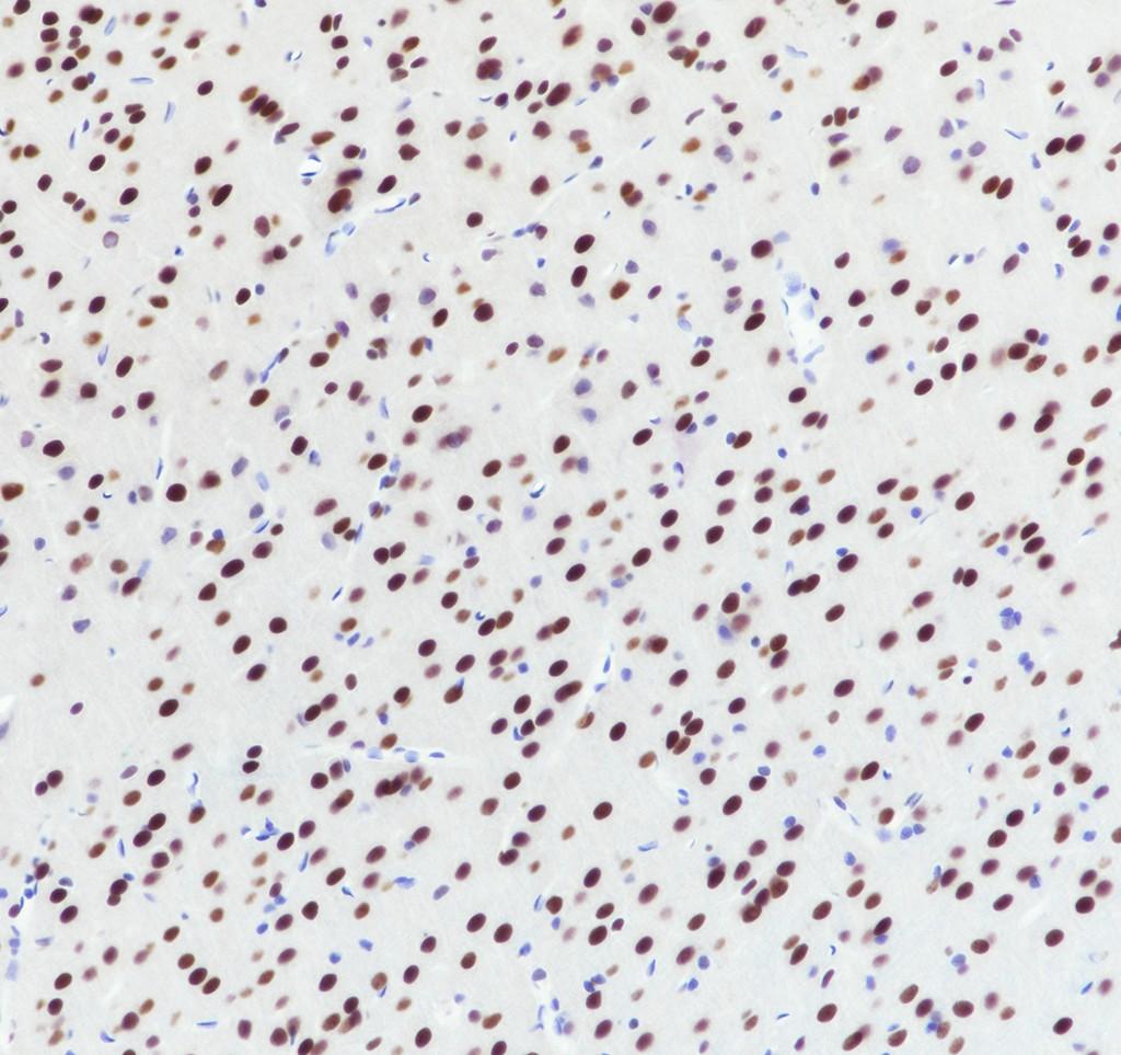 Recombinant U2AF2 Monoclonal Antibody - small - 4