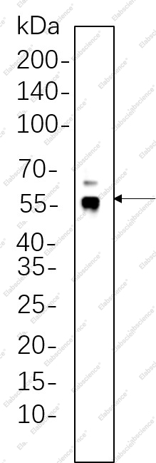 Recombinant ERG Monoclonal Antibody - 1