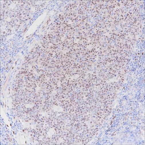Recombinant LMO2 Monoclonal Antibody-searchlist-1