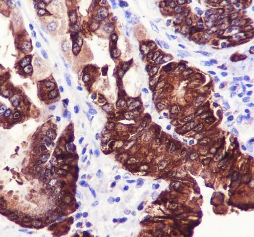 Recombinant TFF1/pS2 Monoclonal Antibody - 3