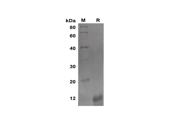 Recombinant Mouse IL-5 Protein-产品推荐-1