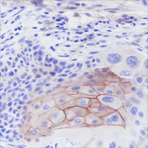 Recombinant Thrombomodulin Monoclonal Antibody - 1