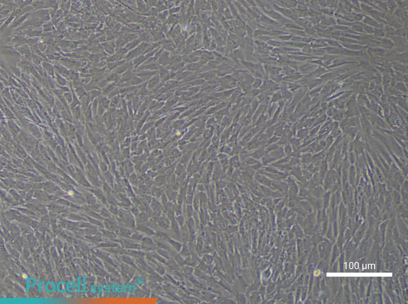 Human Gastric Cancer Fibroblast Complete Medium - 3