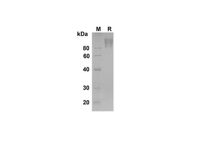 Recombinant Human CDH1 Protein(Sumo Tag)-产品推荐-1