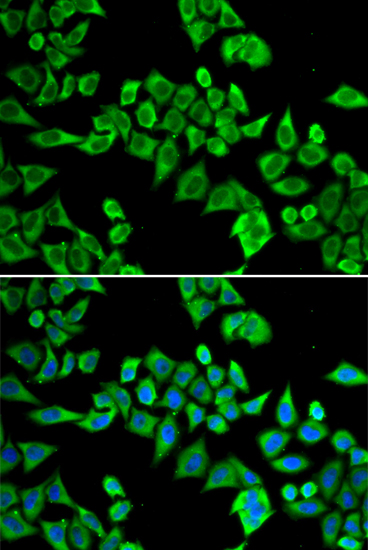 Immunofluorescence analysis of HeLa cells using DDX20 Polyclonal Antibody Blue: DAPI for nuclear staining.