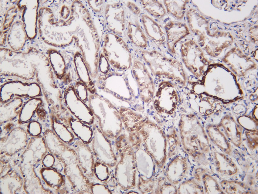 Recombinant IFNGR1/CD119/IFN-gamma-R1 Monoclonal Antibody - small - 4